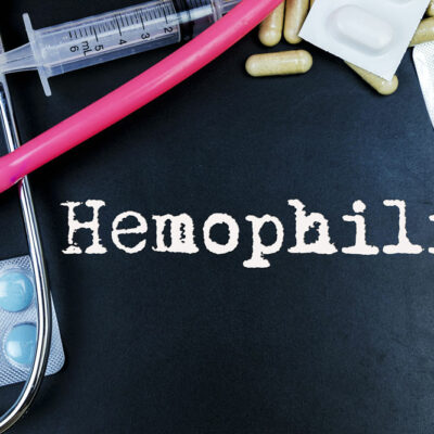 4 Critical Risk Factors for Hemophilia